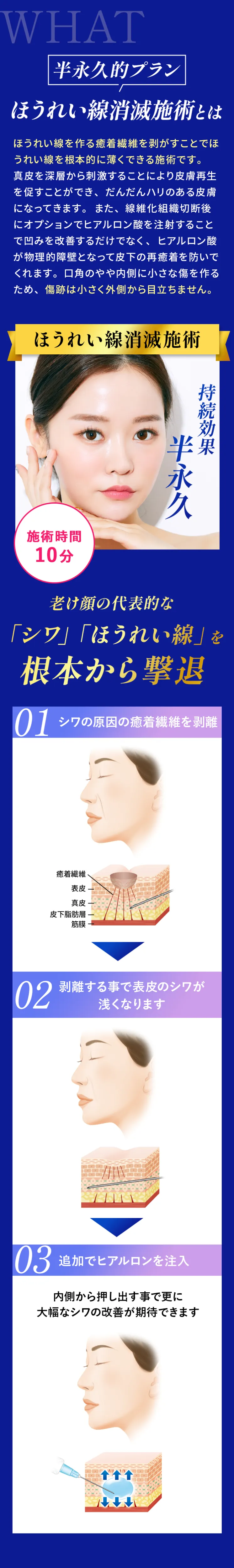 ほうれい線消滅術とは